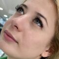Medeo Extreme Serisi 3 Aylık Lens SİLVER